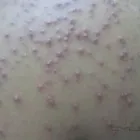 La imagen 4 de la Empresa DERMATOLOGIA DRA LEONARDIS 24 HORAS 365 DIAS Medicos Pediatras en Caracas M