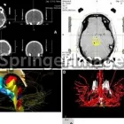 La imagen 2 de la Empresa DR. JESUS FARIÑAS YANES. Neurocirujano en Caracas. M