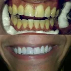 La imagen 1 de la Empresa IMAGEN DENTAL Diseño de Sonrisa en Maracaibo V