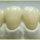 La imagen 5 de la Empresa MECANICA DENTAL Prótesis en Valencia G