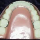 La imagen 6 de la Empresa MECANICA DENTAL Prótesis en Valencia G