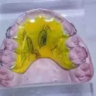 La imagen 8 de la Empresa MECANICA DENTAL Prótesis en Valencia G