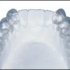 La imagen 13 de la Empresa MECANICA DENTAL Prótesis en Valencia G