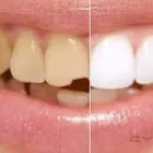La imagen 4 de la Empresa NELDENT ALTA ESTETICA DENTAL Puestes Removibles Flexibles sin Ganchos de Metal en Guatire M