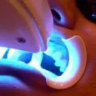 La imagen 5 de la Empresa NELDENT ALTA ESTETICA DENTAL Puestes Removibles Flexibles sin Ganchos de Metal en Guatire M