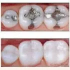La imagen 7 de la Empresa NELDENT ALTA ESTETICA DENTAL Puestes Removibles Flexibles sin Ganchos de Metal en Guatire M