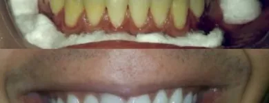 La imagen 1 de la Empresa IMAGEN DENTAL Diseño de Sonrisa en Maracaibo V