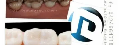 La imagen 3 de la Empresa IMAGEN DENTAL Diseño de Sonrisa en Maracaibo V
