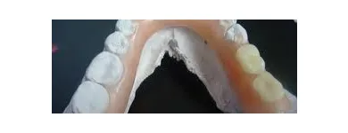 La imagen 1 de la Empresa MECANICA DENTAL Prótesis en Valencia G