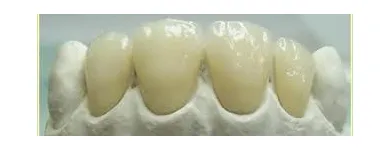 La imagen 5 de la Empresa MECANICA DENTAL Prótesis en Valencia G