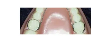 La imagen 6 de la Empresa MECANICA DENTAL Prótesis en Valencia G