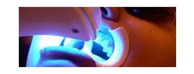 La imagen 5 de la Empresa NELDENT ALTA ESTETICA DENTAL Puestes Removibles Flexibles sin Ganchos de Metal en Guatire M