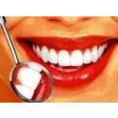 CONSULTORIO ODONTOLOGICO 24 HORAS Resinas en Caracas M